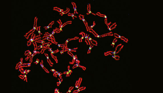 Das Foto zeigt eine mikroskopische Aufnahme von Chromosomen.