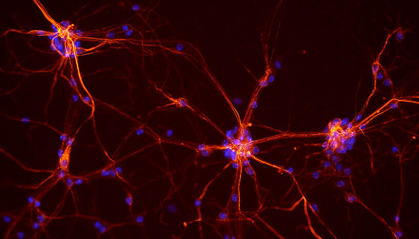 Das Bild zeigt Neuronen des Gehirns.