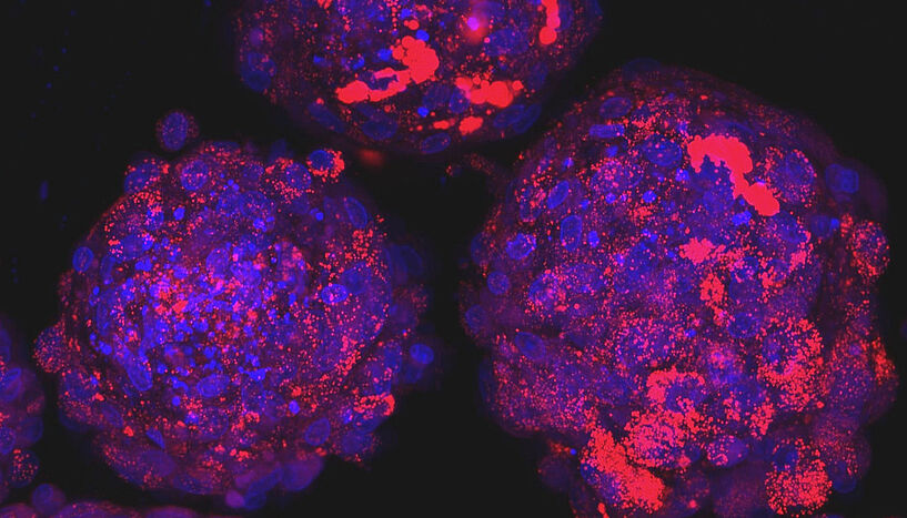 Abb. 1: Abbildung humaner mesenchymaler Stammzellen nach der Differenzierung zu Fettzellen und Anfärbung der Fettvakuolen