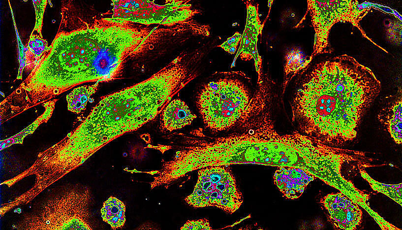 In vitro Zellkultur mit stimulierten Makrophagen, die bunt leuchten