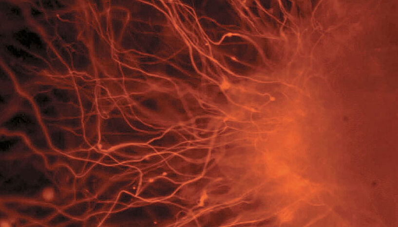 Neuron-Tochterzelle einer menschlichen embryonalen Stammzelle