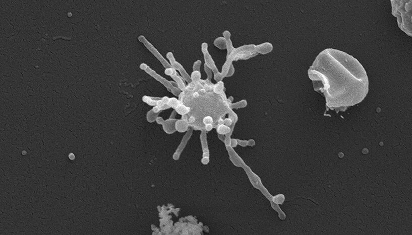 Scanning electronic image. In black and white, a roundish cell with several worm-like appendages.