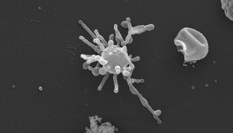 Scanning electronic image. In black and white, a roundish cell with several worm-like appendages.
