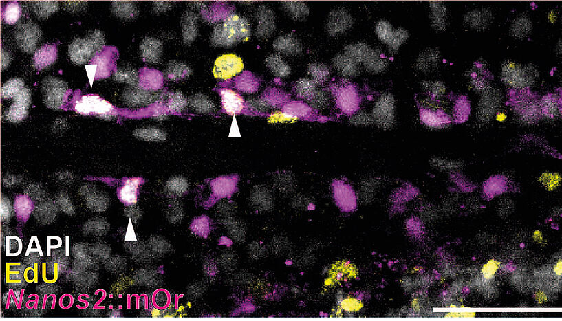 Fig. 2: Laser scanning microscope picture of the body of the sea anemone Nematostella vectensis.The red fluorscence (Nanos2) marks the transgenic putative stem cells, white (DAPI) are all cell nuclei and yellow (EdU) those cells that are actively engaged in DNA-synthesis, hence in the cell cycle like some of the stem cells.