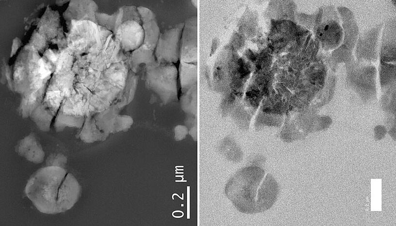 Scanning transmission electron microscopy image of M. sedula
