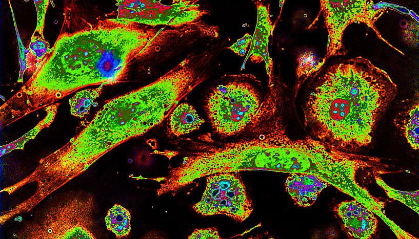Eine eingefärbte Zellkultur zeigt unterschiedliche Charakteristiken der Makrophagen.