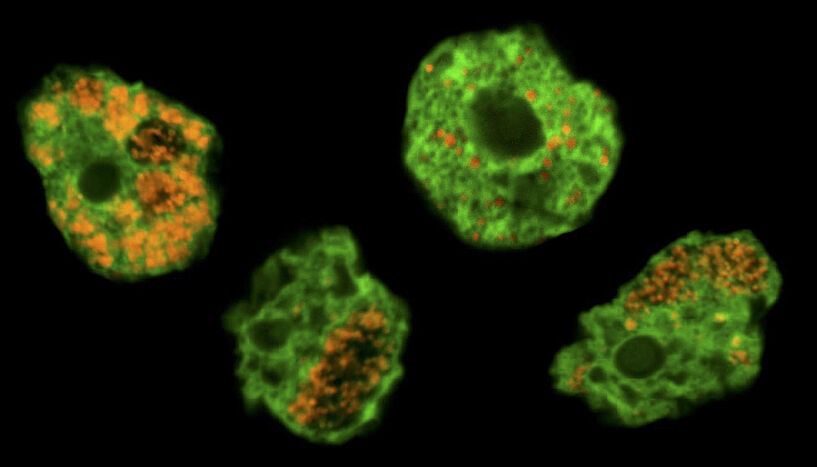 Abb. 1: Chlamydien, die als bakterielle Krankheitserreger des Menschen bekannt sind, entwickelten sich ursprünglich in einzelligen Mikroorganismen, lange bevor sie die Fähigkeit erlangten, Menschen zu infizieren. Das Bild zeigt Bodenamöben (grün markiert) und ihre Chlamydien-Symbionten (orange markiert). 