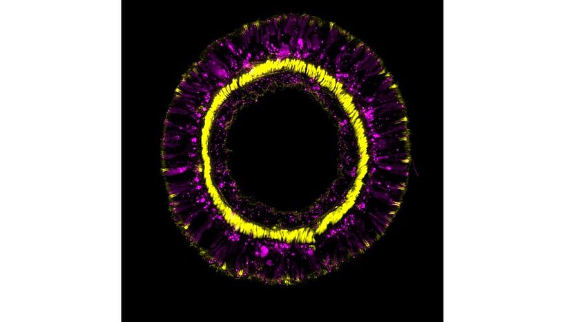 Fig. 1 : Cross-section through a tentacle of a transgenic sea anemone showing differentiation products of the SoxC cell population (magenta) and retractor muscles (yellow).
