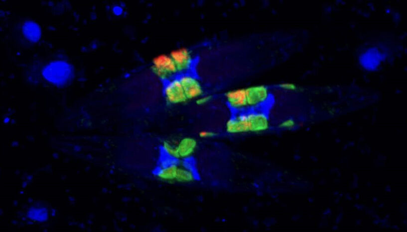 Abb. 3: Eine Gruppe von Kieselalgen mit ihren Fluoreszenz-markierten Symbionten 