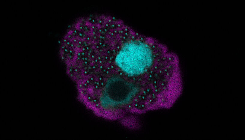 Abb. 2: Eine mit dem Naegleriavirus infizierte Amöbenzelle. In der fluoreszenzmikroskopischen Aufnahme ist die sogenannte Virusfabrik sowie dort frisch produzierter Viren (in hellblau) innerhalb der Amöbenzelle (lila) zu erkennen.
